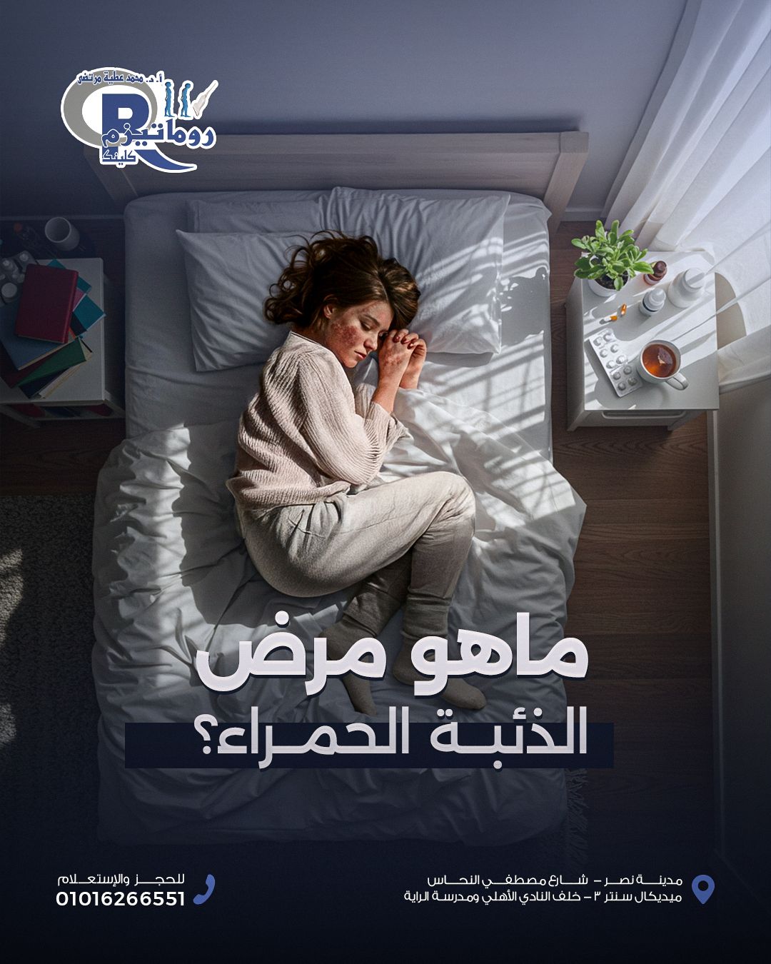  الذئبة الحمراء: مرض مناعي مزمن يصيب النساء بشكل أكبر
